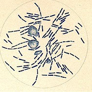 bacilli of anthrax